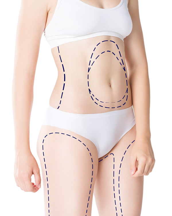 The Importance of Manual Lymphatic Massages (MLD) and Compression Garments  for Postoperative Recovery After Cosmetic Surgery - RECOVA®